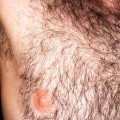 hairy men